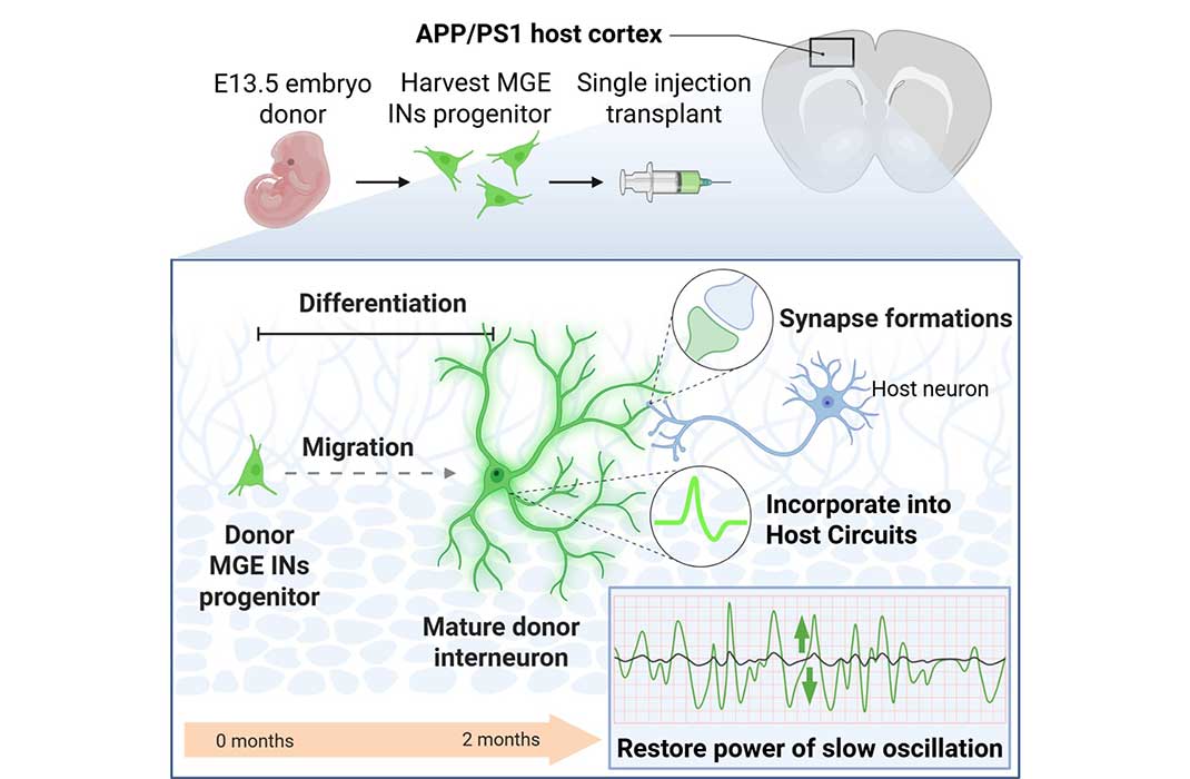 Research Spotlight: Using Stem Cell Therapy to Rescue a Critical Sleep Rhythm Affected in Alzheimer’s Disease