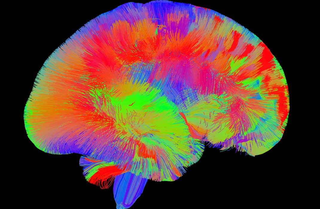 A Peek Inside the Brain: Can You Guess What the Image Is?