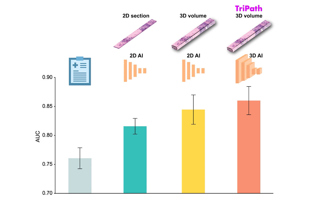 Tripath graphic