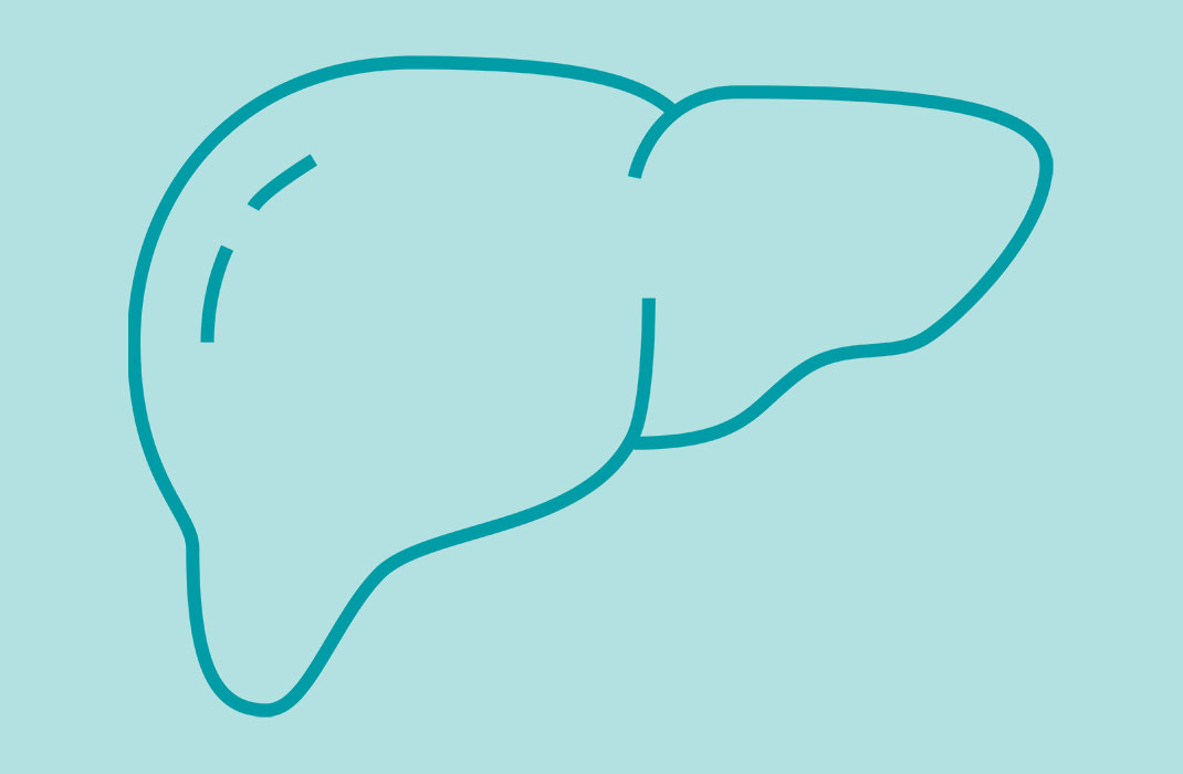 Liver-Directed Therapy Offers Effective Treatment for Rare Metastatic Uveal Melanoma