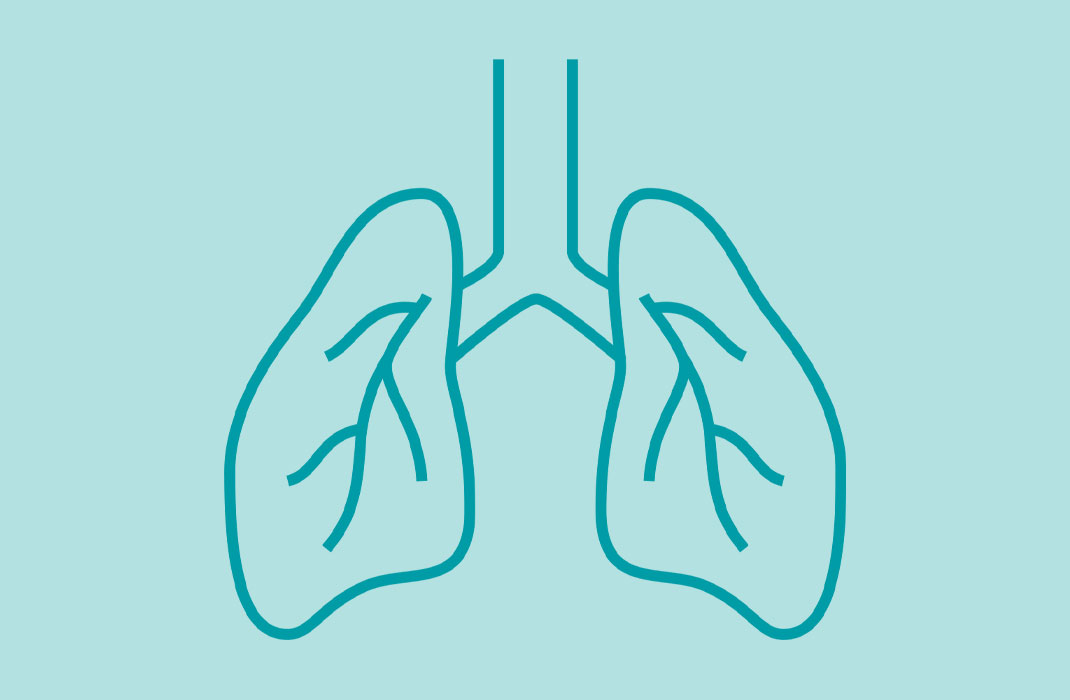 Efforts Underway to End Race-Based Assessments of Lung Function