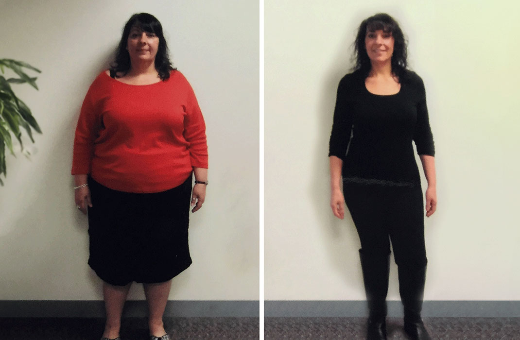 Newton-Wellesley Hospital Center for Weight Loss Surgery patient before and after bariatric surgery