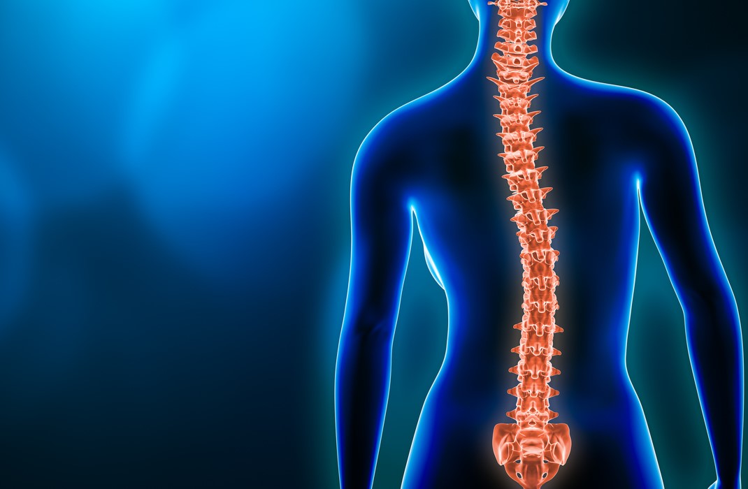 How to Manage Adult Scoliosis