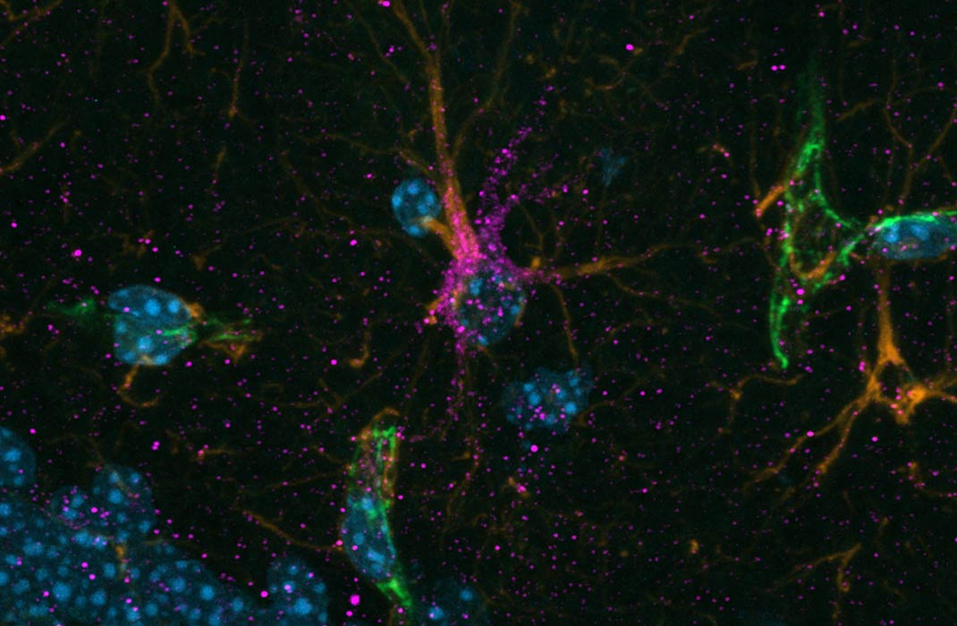 Researchers Identify How Physical Activity Protects the Brain—Cell by Cell—in Alzheimer's Disease