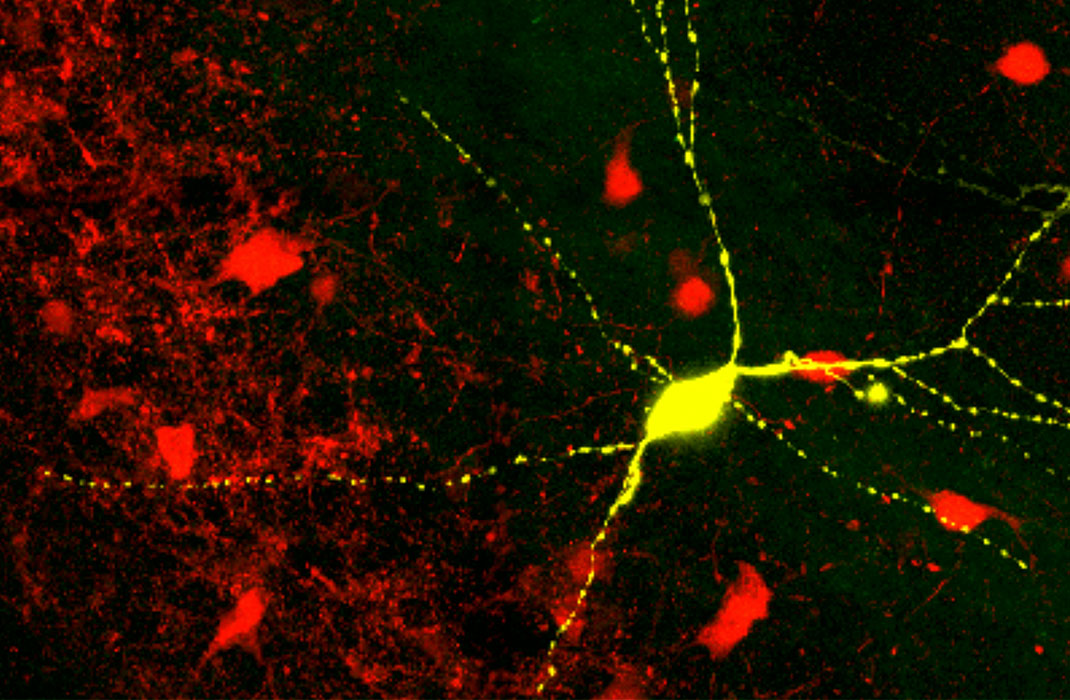 Preclinical Study Suggests Restoring Inhibitory Neuron Plasticity May Reverse Neurodevelopmental Disorder Symptoms