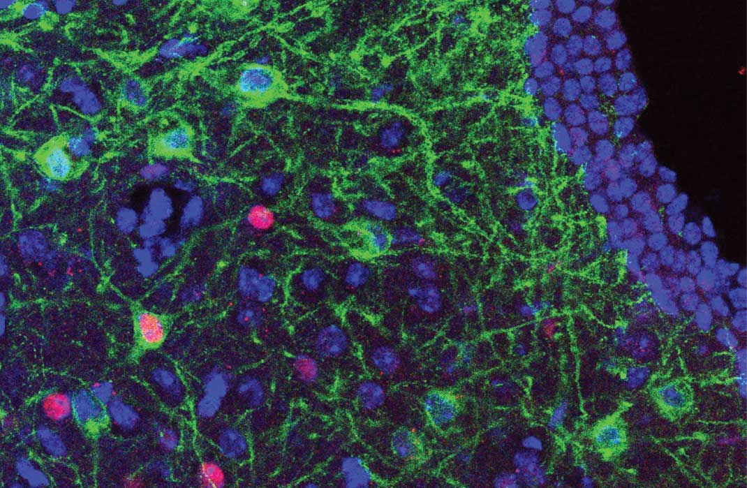 Researchers Identify Brain Circuit and Cells that Link Prior Experiences to Appetite