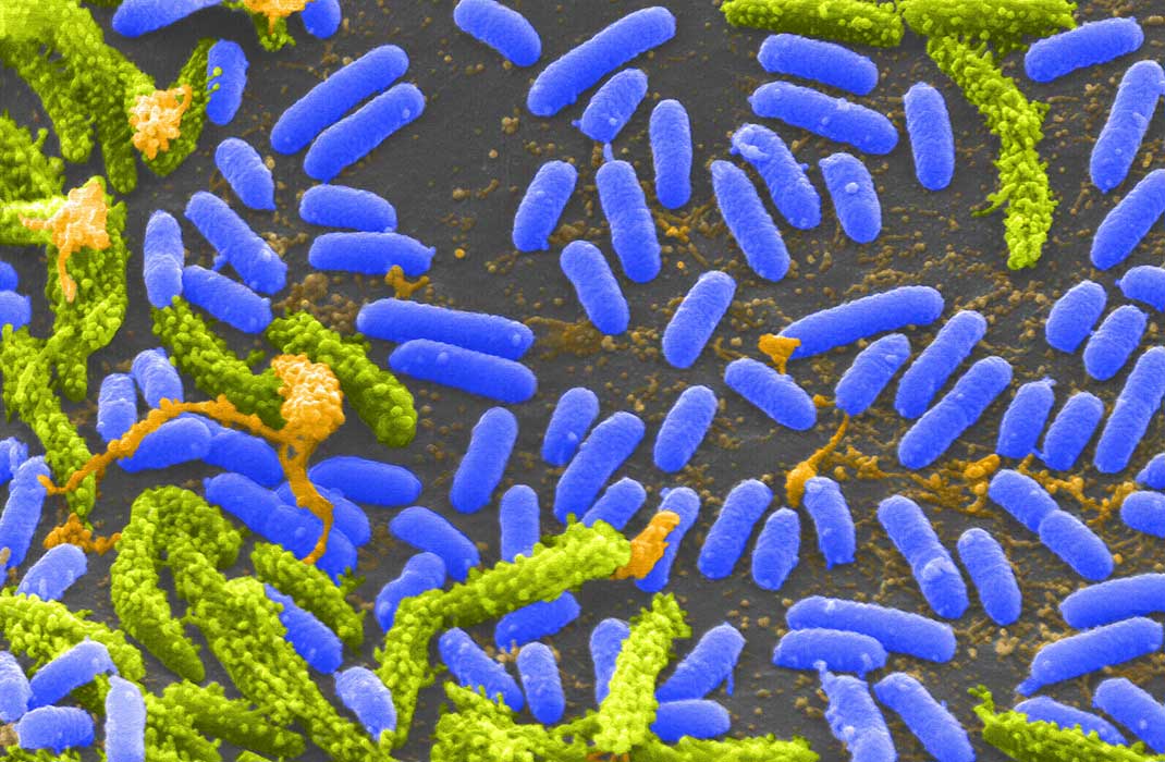 Mass General Brigham–Developed Cholera Vaccine Completes Phase 1 Trial