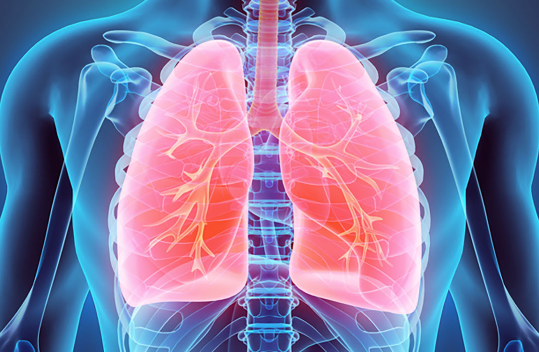 3D model of a male chest with the lungs highlighted.