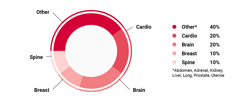 Pie chart: Other 40%, cardio 20%, brain 20%, breast 10%, spine 10%. Other includes abdomen, adrenal, kidney, liver, lung, prostate, uterine.