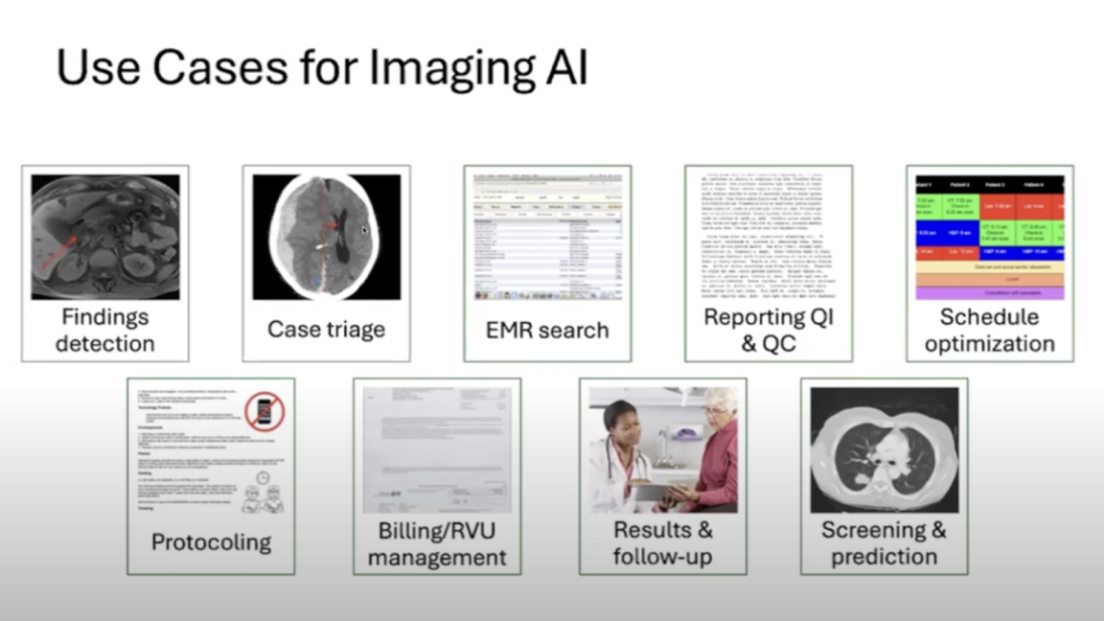 video screenshot of. If a picture is worth a thousand words, what are words worth? Natural language processing and the future of radiology. 