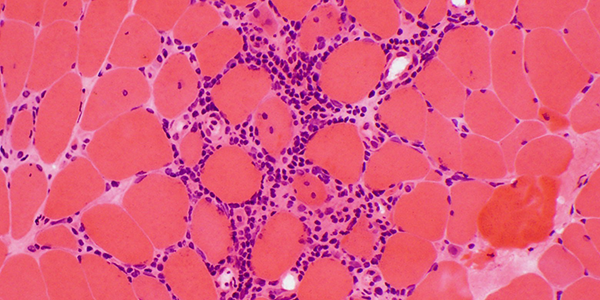 zoomed in view of cells
