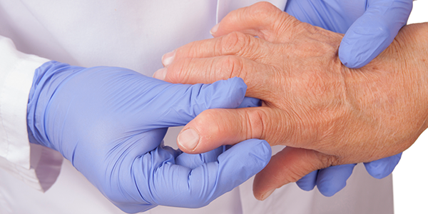 doctor examining hand of a patient