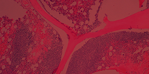 slide showing zoomed in cells dyed red