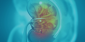 kidney medical illustration