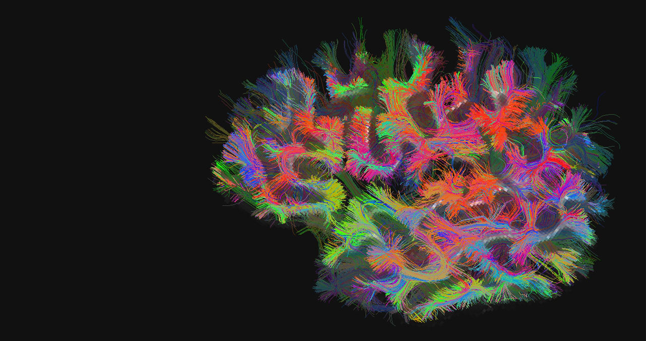 A map of brain connections computed from a diffusion MRI (dMRI) scan.