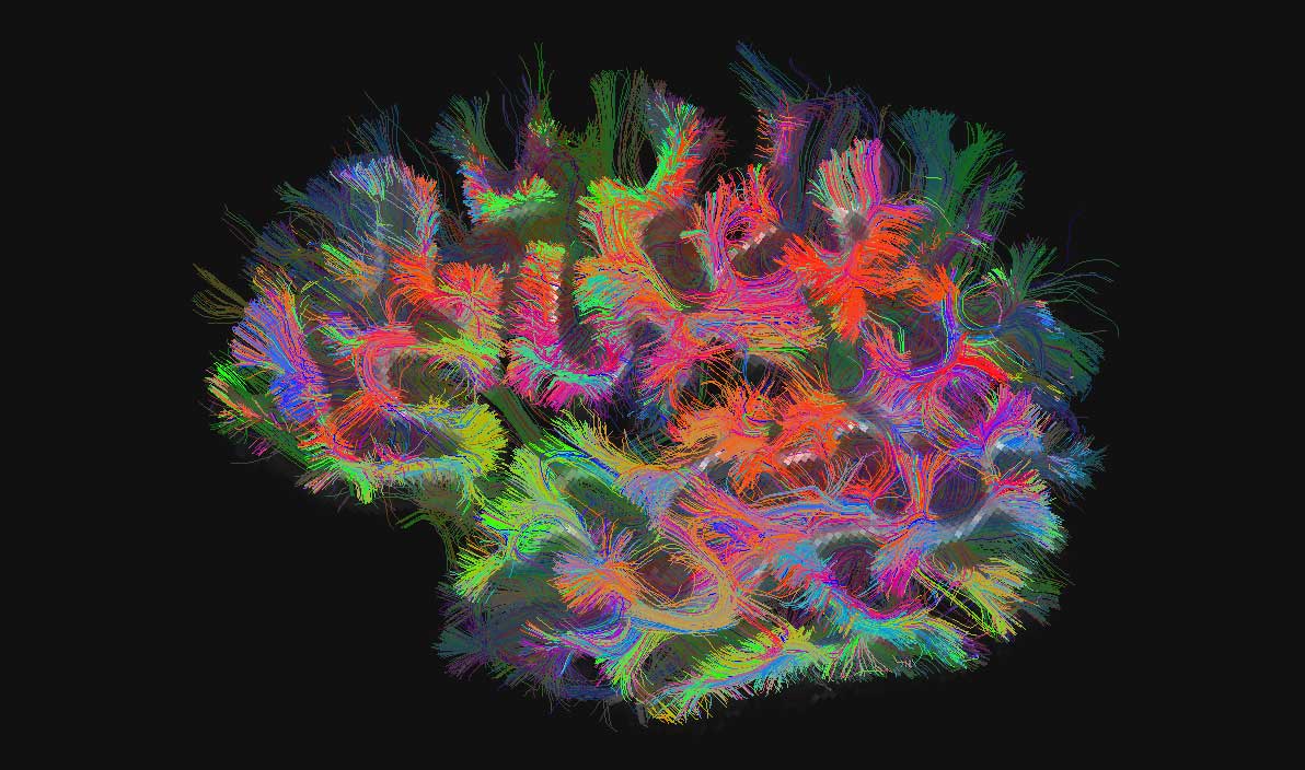 Neural networks mapped out in different colors.