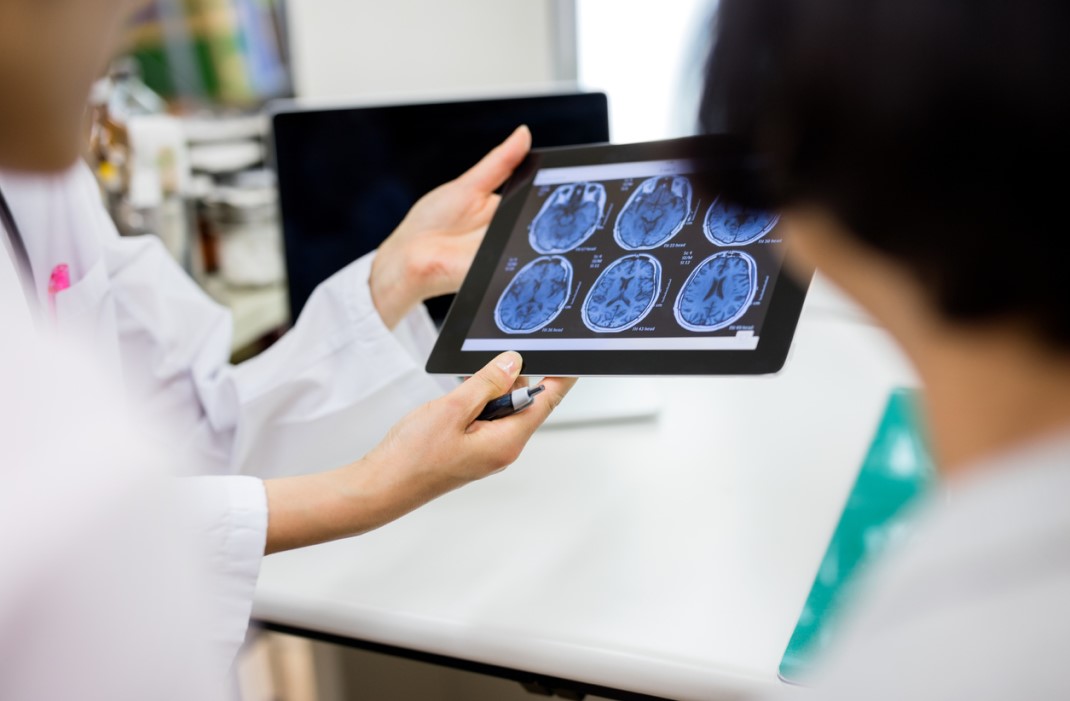 doctors looking at a brain scan