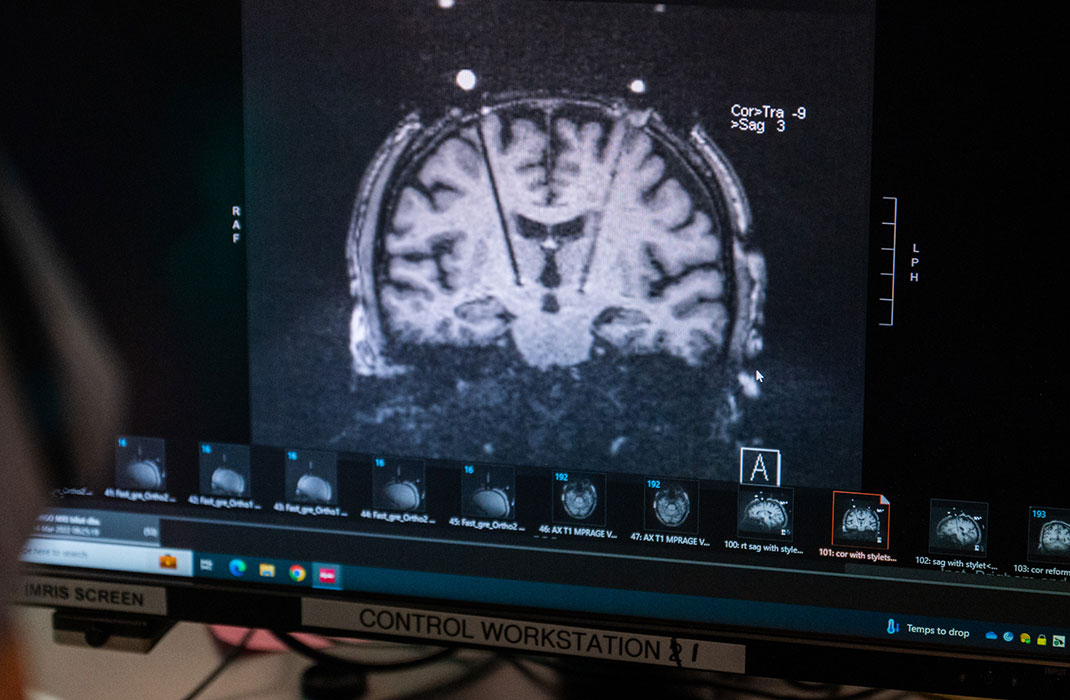 A screen depicting a brain scan. 