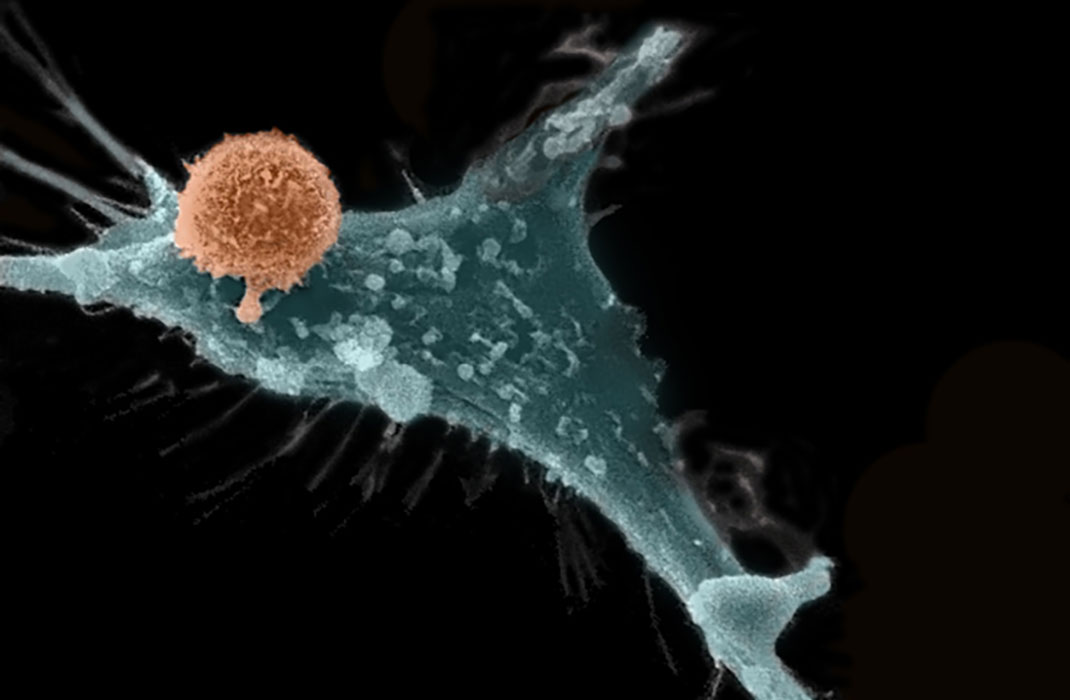 Image of a cell observed under an electron microscope