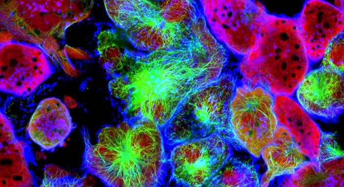 Cancer cells