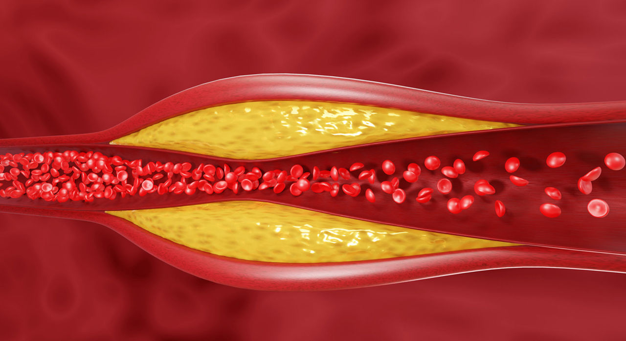 How it's made: Cholesterol production in your body - Harvard Health