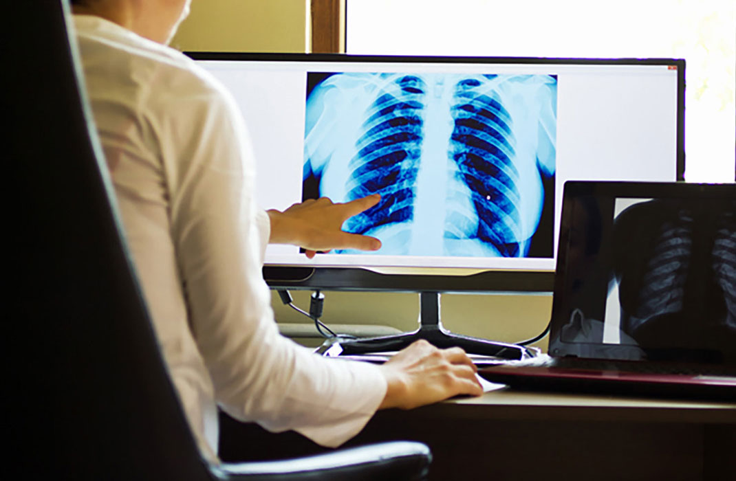 Doctor points at x-ray on computer screen
