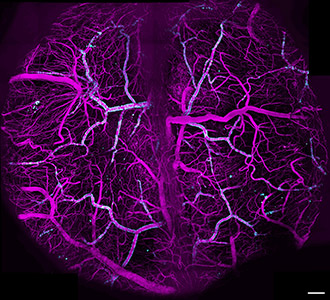 A map of blood vessels