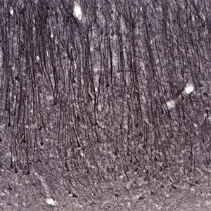 Neuron cell bodies in the hippocampus