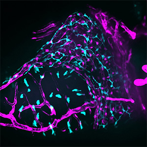 Liver cells