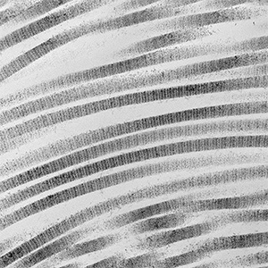 Collagen fibers