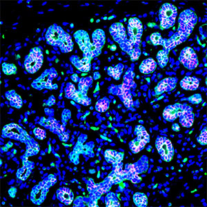 Stained with IL-4 Receptor-α(Green) and CD117(marker for luminal progenitors, Red), a few normal human breast glands exhibit the shape of 'Heart' in the cluster by chance
