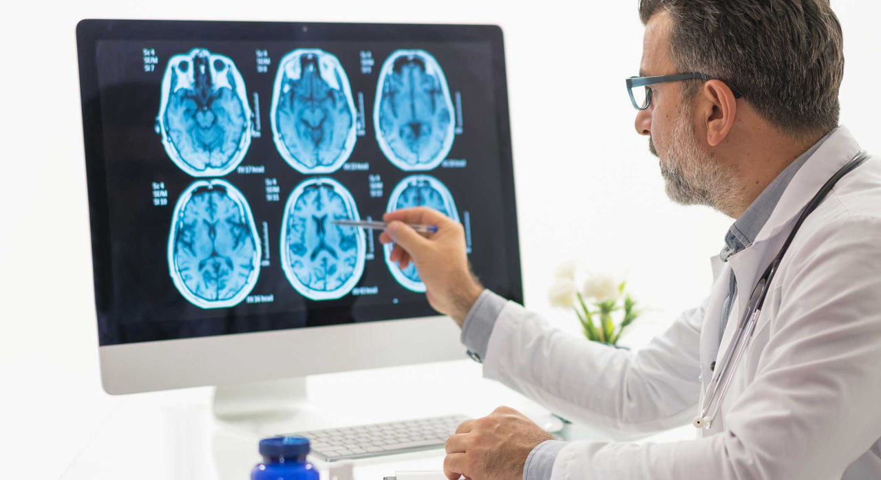 A doctor reviews brain tumor MRI scans.