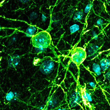 Confocal microscopy image of donor cells in the host cortex, with donor cells labeled in green and cell nuclei stained with DAPI in cyan.
