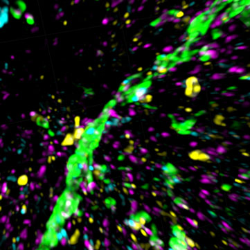 Donor nerve fibers (green) making connections in the host brain, with colored dots marking where those connections form.