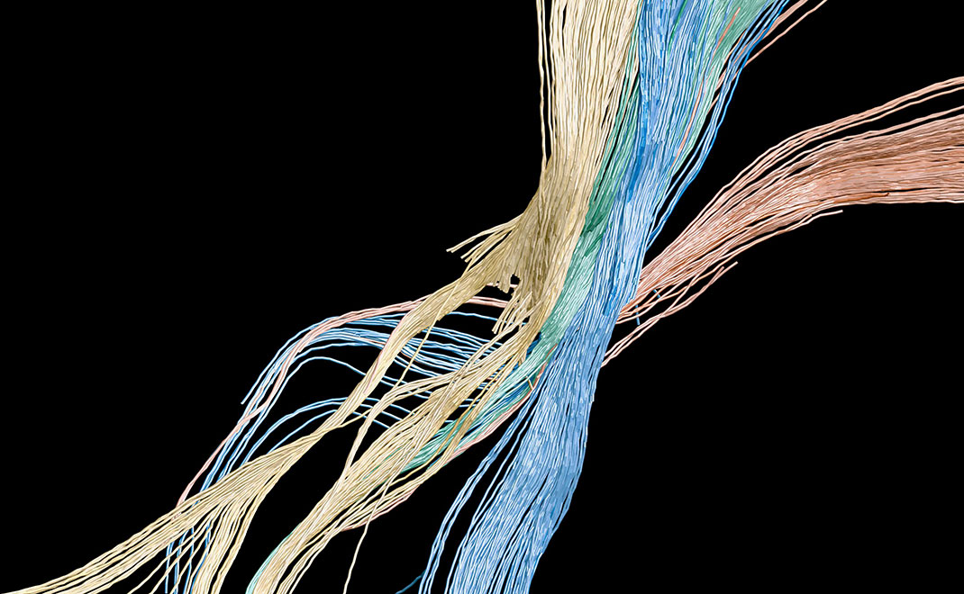 Red, yellow, green, and blue brain fiber bundles.