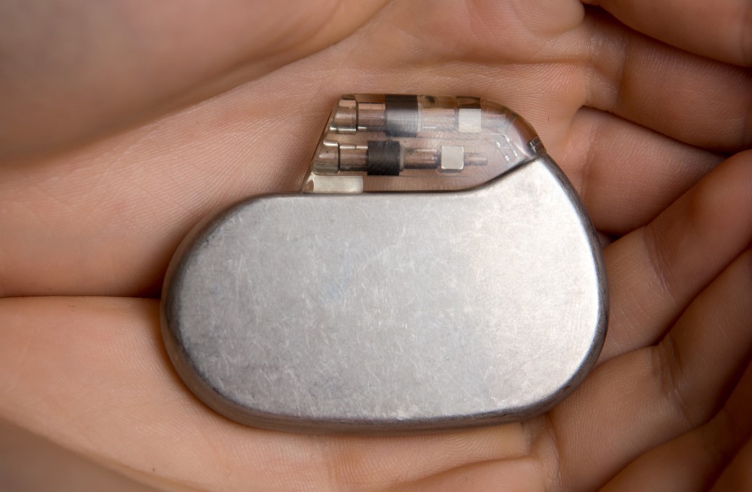 A pacemaker in the palm of a hand