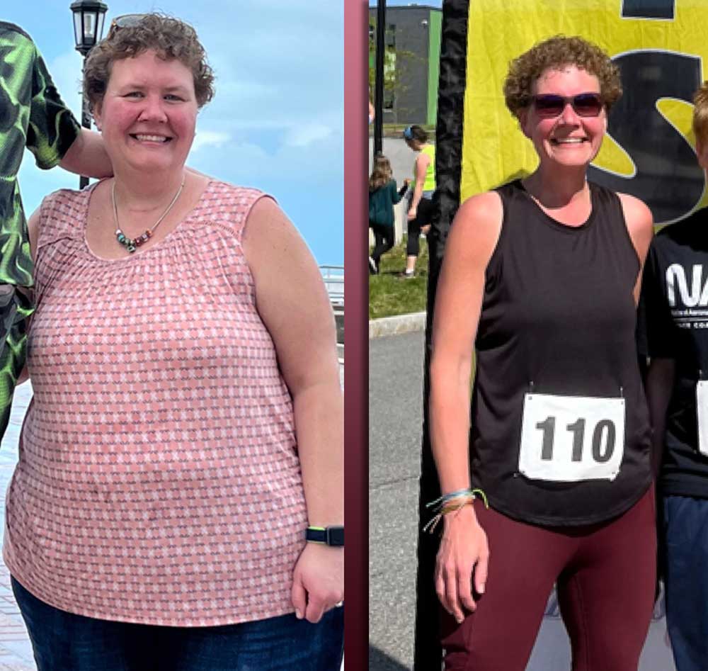 Carrie before weight loss surgery, looking heavy, and after weight loss surgery, thin and athletic as she enters a marathon.