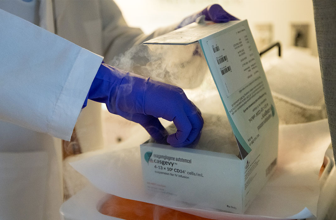 A gloved and lab-coated researcher reaching into a cryogenic storage box of Casgevy, a cutting-edge gene therapy for SCD.