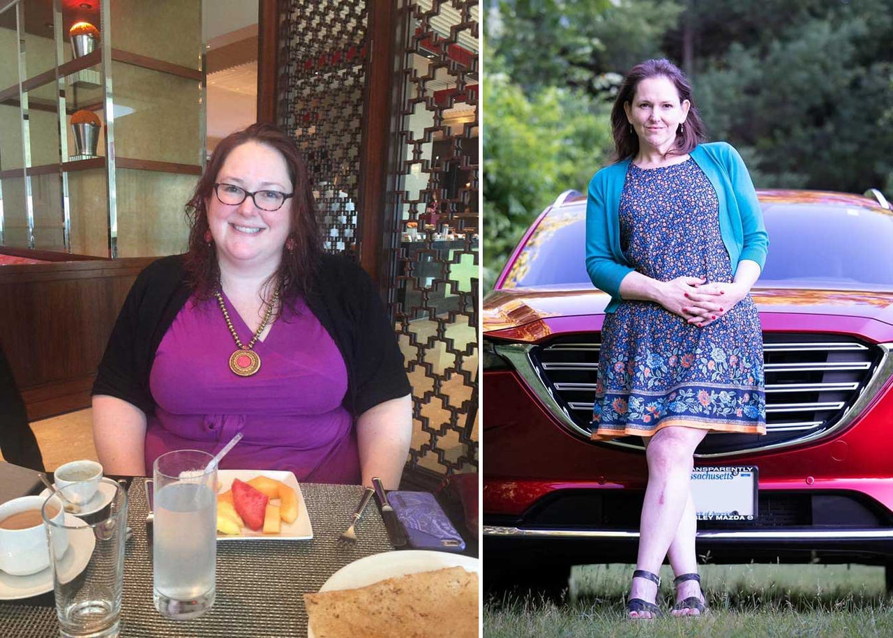 Julie Bice before and after bariatric surgery.