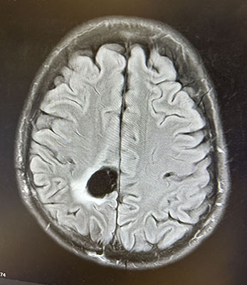 Cory’s brain scan. 