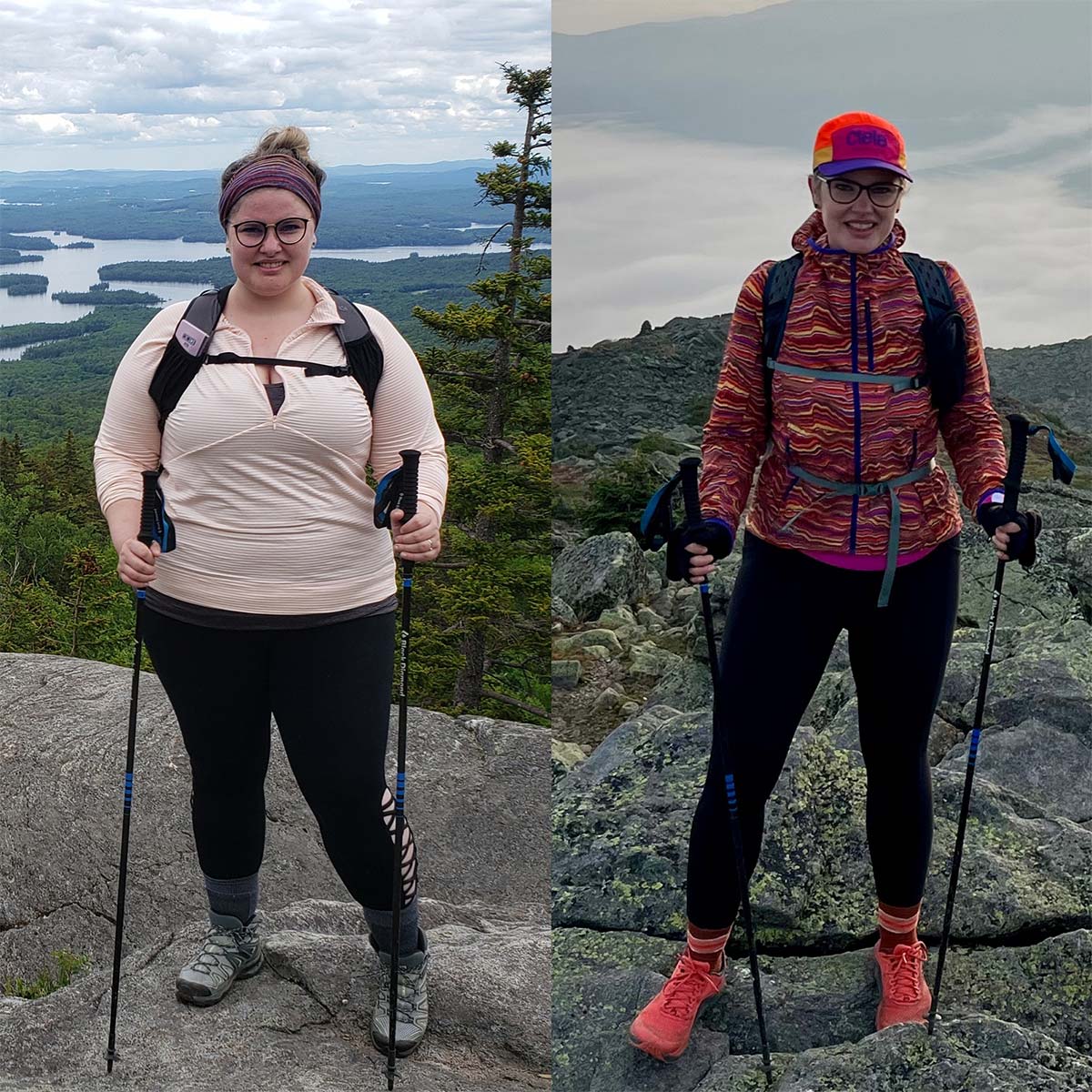 Weight loss surgery patient on a hike, before and after gastric bypass