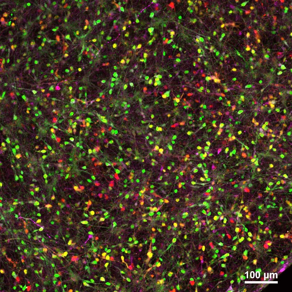 A tangle of green, yellow, and red neurons joined by thin lines, with occasional crackles of bright purple.