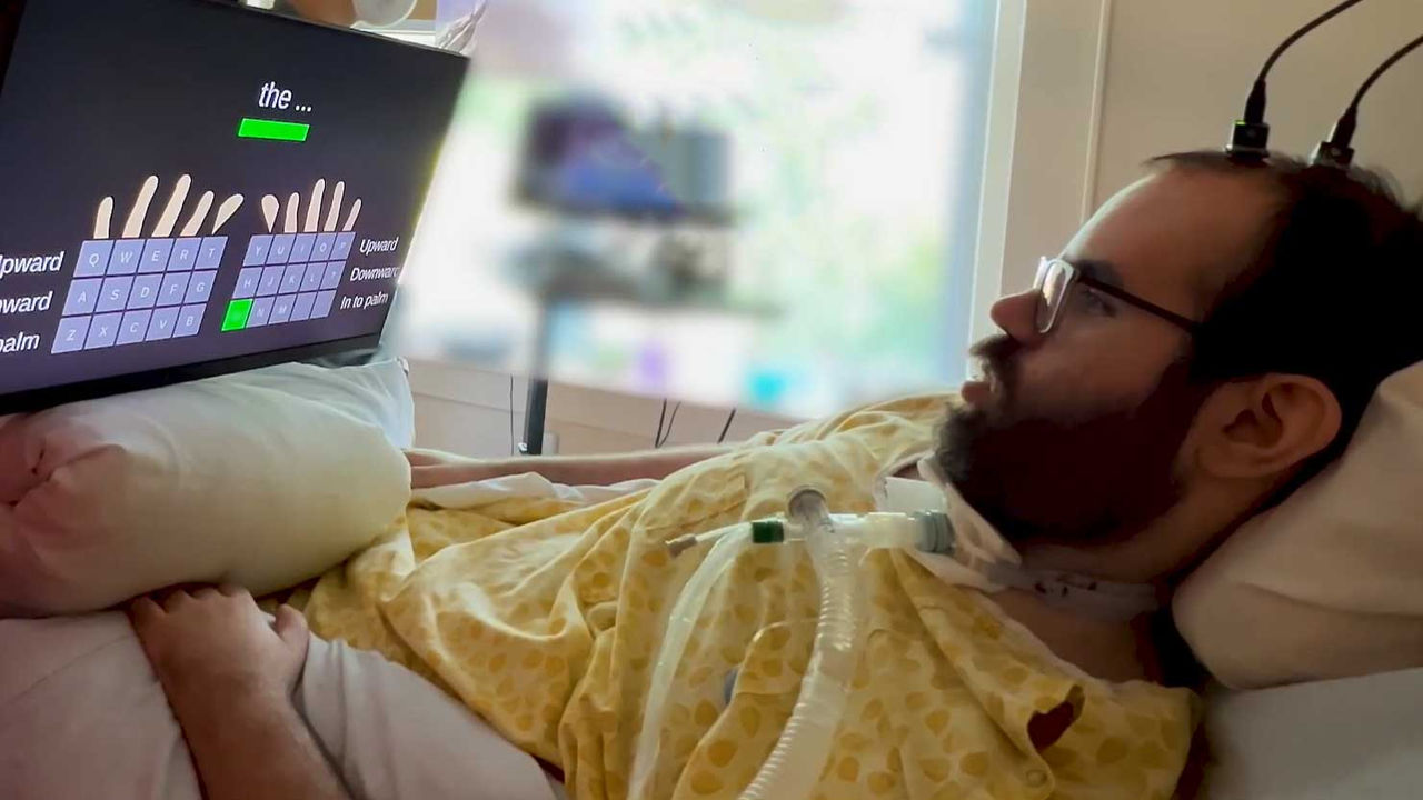A paralyzed man lies in bed, looking at a screen while a program interprets his brainwaves in order to type. Two electrodes are implanted into his scalp, with wires leading offscreen.