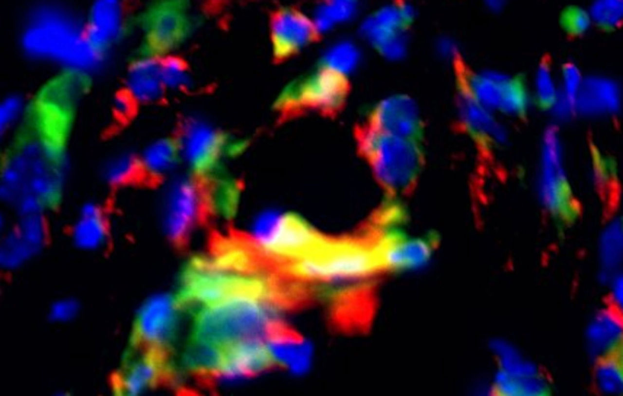 Multicolored blotches on an immunofluorescence image.