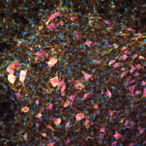 A microscopy image showing exercise hormone irisin in yellow binding to spinal cord neurons in magenta and cell nuclei in blue within a mouse model of multiple sclerosis (MS).