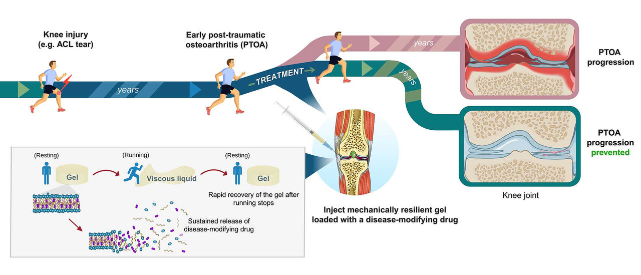 Diagram showing how injecting hydrogel into the knee joint can prevent PTOA progression.