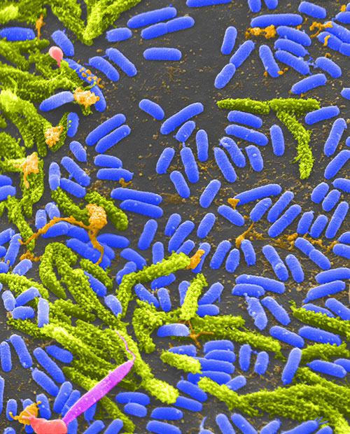 A microscopic image showcasing Vibrio bacteria in blue and green hues. The bacteria are rod-shaped and surrounded by organic structures, with additional pink and orange elements visible. The image highlights microbial life in a scientific manner.