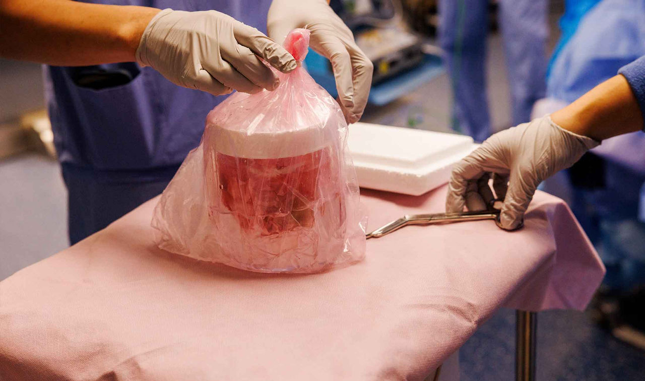 close up of pig kidney in jar in operating room