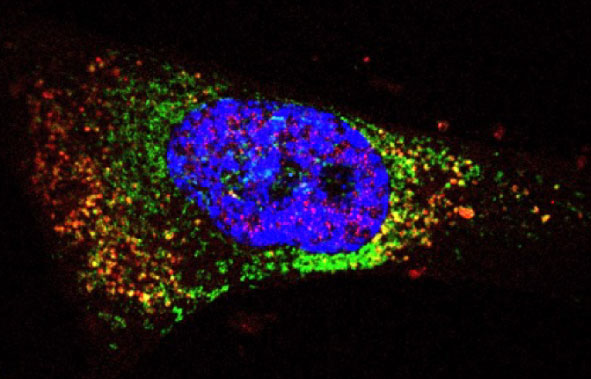 Loss of WSTF during chronic inflammation.