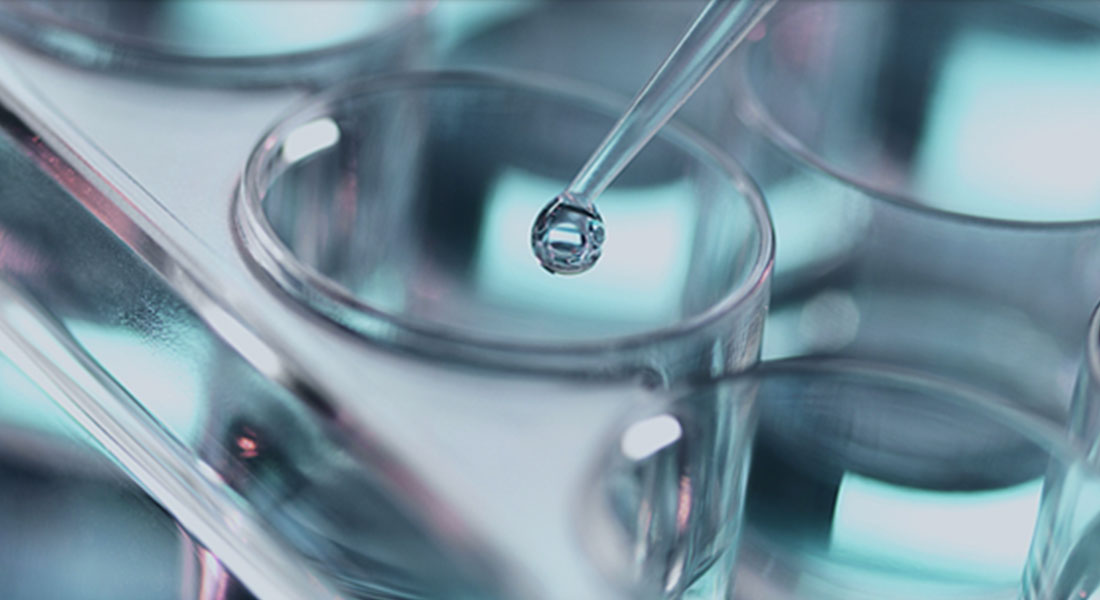 a pipette and test tube